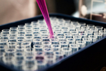 The photo presents a pipette containing pink liquid inserted into one of many clear sample tubes arranged in a laboratory rack.